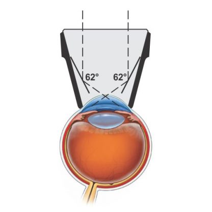 YAG Capsulotomy